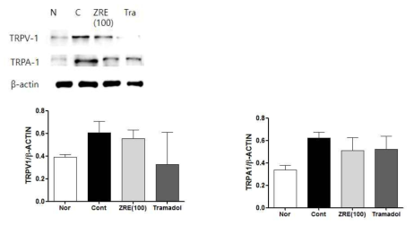 Western blotting of TRPV1 and TRPA1 expressions in ipsilateral L5 DRG in spread nerve injury, *P<0.05, **P<0.01, ***P<0.001 vs. normal (a) or control (b) group