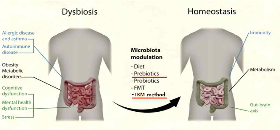 장내 미생물의 균형에 변형을 줄 수 있는 요인(West et al., 2015) (Fecal microbiota transplantation, FMT; Traditional korean medicine, TKM)