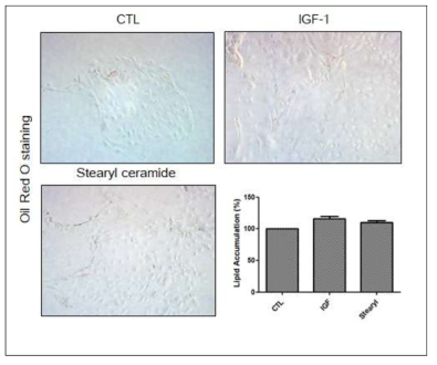 Oil Red O 염색을 통한 IGF-1와 stearyl ceramide에 의한 지질 분비 측정