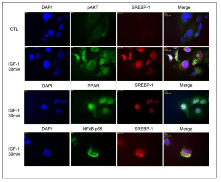 IGF-1 (100ng/ml) 단독 처치에 따른 AKT, PPAR, NFkB, SREBP-1 발현 상태 측정