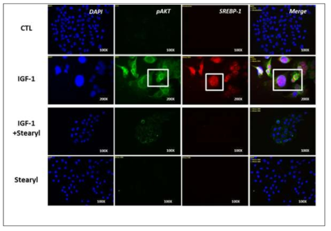 AKT, SREBP-1의 발현위치를 형광염색을 통해 확인