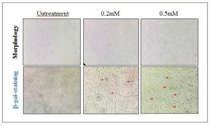 β-gal staining 분석