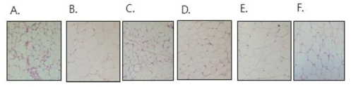 H&E staining of fat from rat A. Control: salin, B. HFD:high fat diet (60 kcal% fat) + probiotics, C. VC20: high fat diet (60 kcal% fat) + probiotics + VC20, D. VC100: high fat diet (60 kcal% fat) + probiotics + VC100, E. VC300: high fat diet (60 kcal% fat) + probiotics + VC300, F. FOS: HFD+VC20: high fat diet (60 kcal% fat) + probiotics + fructooligosaccharide (2.5 g/kg BW/day)