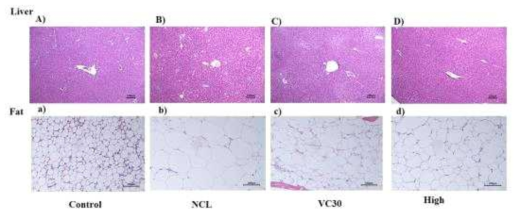 Effect of blueberry biscuit and Lactobacillus acidophilus on HFD-supplemented mice. A) and a): Control: AIN93G + White biscuit 20 mg/day +Lactobaillus acidophilus ATCC 4356 109-1011 CFU, B) and b): NCL; High fat diet + White biscuit 20 mg/day + Lactobaillus acidophilus ATCC 4356 109-1011 CFU, C) and c):VC30:High fat diet + White biscuit 20 mg/day +Lactobaillus acidophilus ATCC 4356 109-1011 CFU + bluberry 30% ethanol extract 20 mg/bw·kg/day, D) and d):High: High fat diet + blueberry biscuit 20 mg/day +Lactobaillus acidophilus ATCC 4356 109-1011 CFU