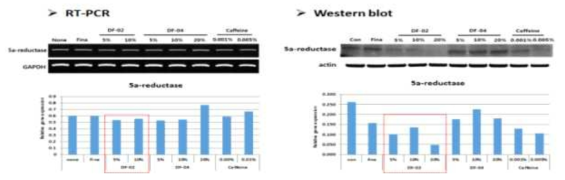 5a-reductase의 유전자(RT-PCR)와 단백질(Western blot) 발현 양상 결과