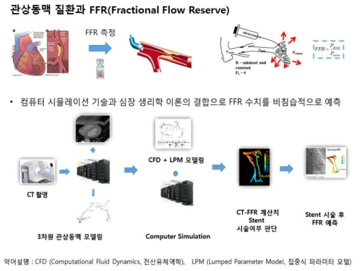 관상동맥 질환과 FFR 측정 및 예측 모형