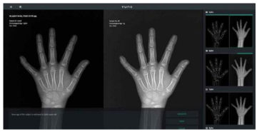 인공지능 기반 X-Ray 영상 분석 소프트웨어