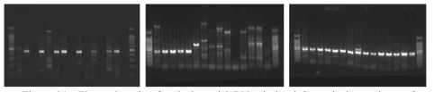 Electrophoresis of actinobacterial DNA isolated from single specimen of Actinobacteria in Lake Paldang