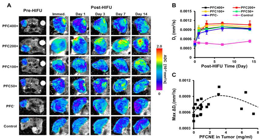 PFCE-NE를 주사한 종양 동물 모델에 HIFU를 시행하고 치료 효과를 확산계수 영상법으로 모니터링함. PFCE-NE의 농도에 따라 치료효과가 다름