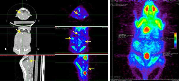 환자 종양 조직을 moue liver에 이종 이식한 모델 제작 후, 암세포의 확인 및 종양 성장을 animal PET/CT를 이용하여 영상화