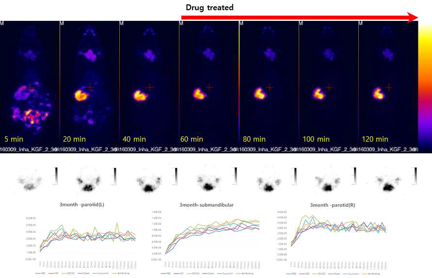 Tc-99m SPECT imaging after I-131 radiotherapy. 갑상선의 방사선치료 후 Tc-99m을 이용한 침샘의 기능성 평가