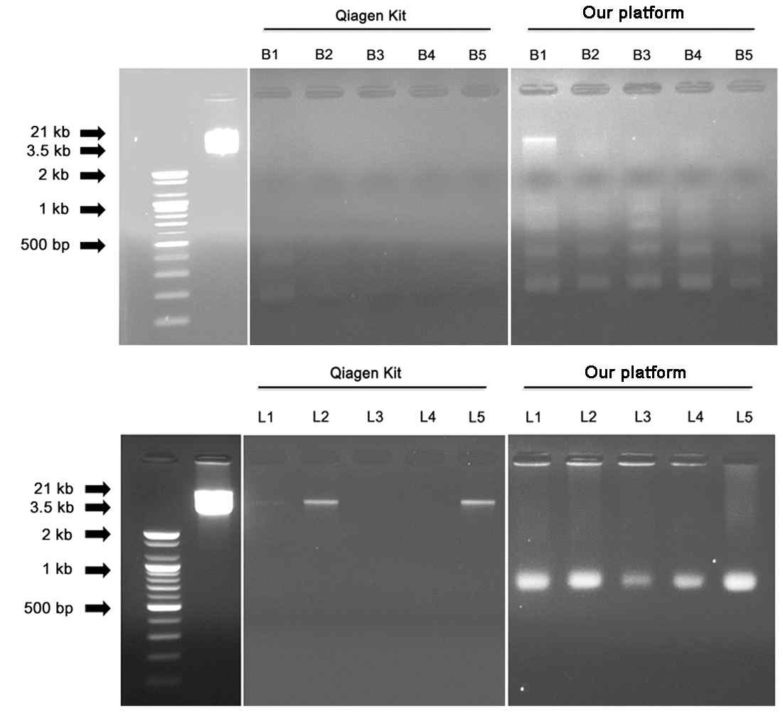 나노구조체 및 Qiagen kit을 통하여 유방암 및 폐암 환자 샘플에서 검출된 cfDNA의 농도를 gel electrophoresis사용하여 비교함