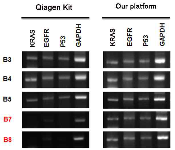 나노구조체 및 Qiagen kit을 통하여 유방암 환자 샘플에서 검출된 cfDNA에 대해 다양한 유전자로 PCR한 결과 탁월한 증폭효율을 보여줌