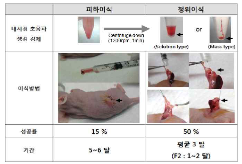 수술 불가능 췌장암 환자의 내시경 초음파 생검 검체를 이용한 환자유래이종이식모델