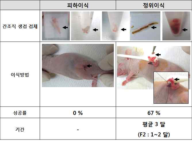 수술 불가능 췌장암 환자의 간 조직 생검 검체를 이용한 환자유래이종이식모델