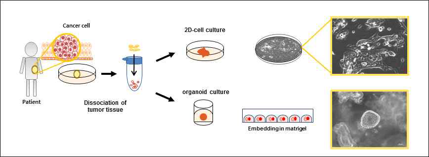 Primary 종양구 분리 및 배양 프로토콜