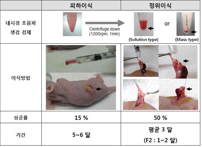 수술 불가능 췌장암 환자의 내시경 초음파 생검 검체를 이용한 환자유래이종이식모델