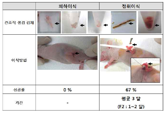 수술 불가능 췌장암 환자의 간 조직 생검 검체를 이용한 환자유래이종이식모델