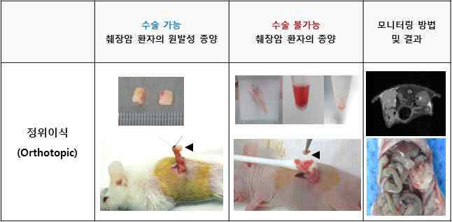 췌장암 환자유래 이종이식 모델 제작 프로토콜