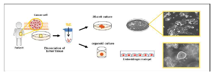 Primary 종양구 분리 및 배양 프로토콜