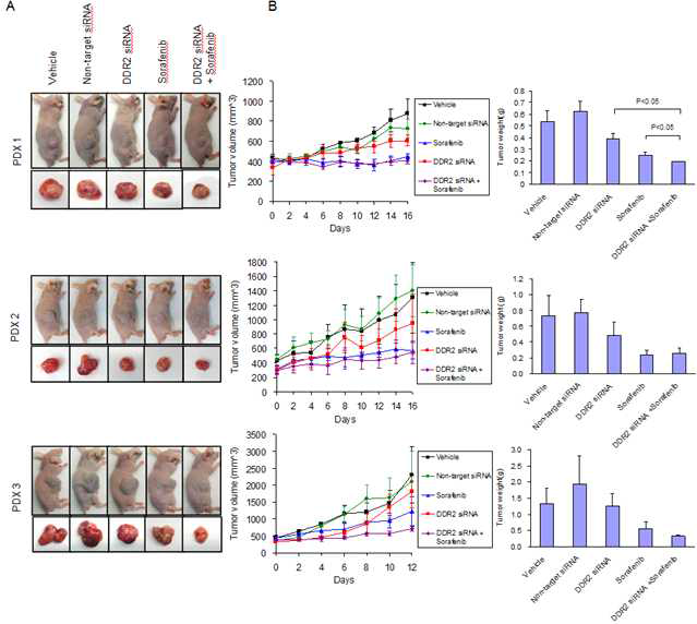 Inhibition of tumor growth by combined treatment with DDR2 siRNA and Sorafenib on HCC tumografts