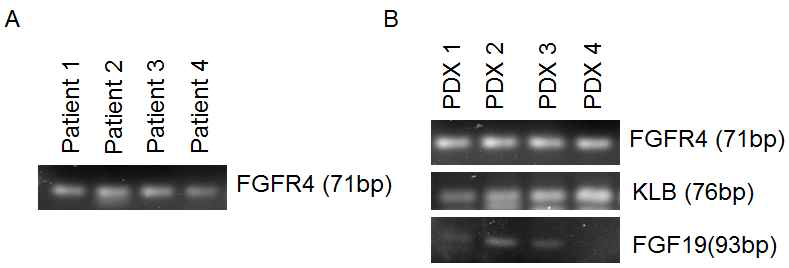 mRNA expression in PDX models and patients