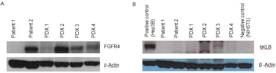 Protein expression in PDX models and patients