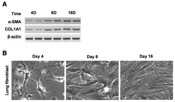 마우스 폐에서 섬유모세포 분리 후 시험관내 배양. A. PCR을 통해 섬유모세포의 gene expression 분석. B. 현미경을 통해 배양된 섬유모세포를 관찰함