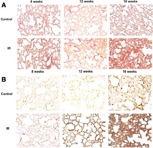 방사선조사 후 마우스 폐조직의 조직학적 검사. A. Sirius-red staining. B. alpha-smooth muscle actin 면역조직화학 염색