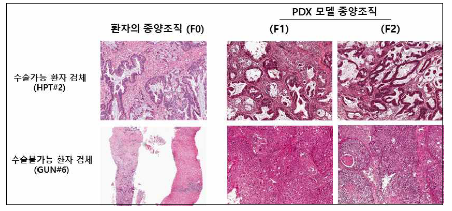 환자의 종양 조직(F0)과 1세대 PDX 모델의 종양조직(F1)의 H&E 염색