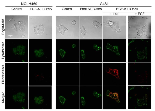 EGF-ATTO655 결합체가 EGFR을 과발현 하는 암세포를 특이적으로 인식하여 형광영상에 사용될 수 있음을 보여주는 자료. Labeling이 되지 않은 과량의 EGF를 co-treatment한 경우에는 EGFR과발현 암세포주 내에서의 형광신호가 줄어들며, 이것은 EGFR에 프루브가 특이적으로 결합한다는 것을 증명하는 자료 임. EGFR음성 NCI-H460과 EGFR양성 A431을 이용하여 공초점 현미경 영상을 얻은 결과