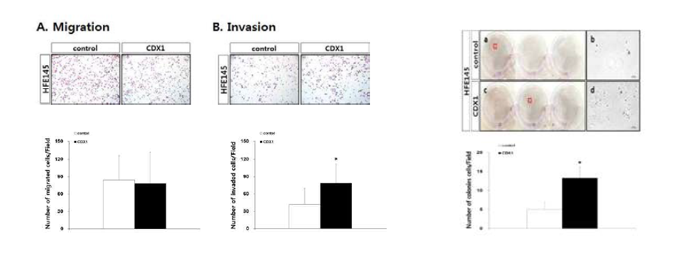 CDX1 induced migration and invasion in gastric epithelial cells