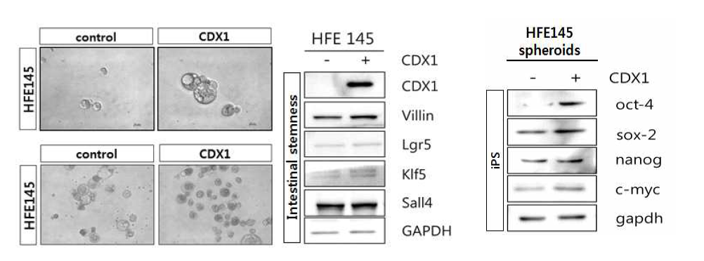 Overexpression of CDX1 led to a cancer stem cell-like phenotype in gastric epithelial cells