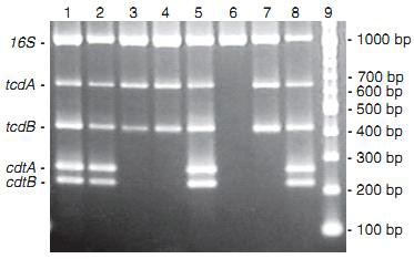 C. difficile에 특이적인 프라이머 (16S rDNA, tcdA, tcdB, cdtA 및 cdtB)를 이용한 그림. C. difficile에 특이적인 프라이머 (16S rDNA, tcdA, tcdB, cdtA 및 cdtB)를 이용한 multiplex PCR 결과