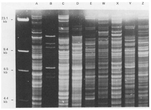 C. difficile BI/NAP1/027 standard strain의 REA 패턴 분석 결과 (A-E, W-Z)로, 이러한 패턴을 보이는 균주를 BI로, 그 외는 non-BI group으로 분류할 수 있음