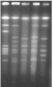 C. difficile BI/NAP1/027 standard strain의 PFGE 패턴 분석 결과로, 이러한 PFGE 패턴 분석을 통해 NAP1 strain을 확인할 수 있음