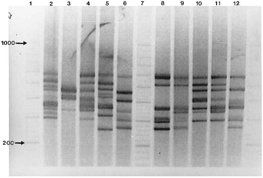 C. difficile BI/NAP1/027 standard strain의 ribotyping PCR 전기영동 결과로, 해당 패턴을 보이는 경우 ribotype 027로 결정함