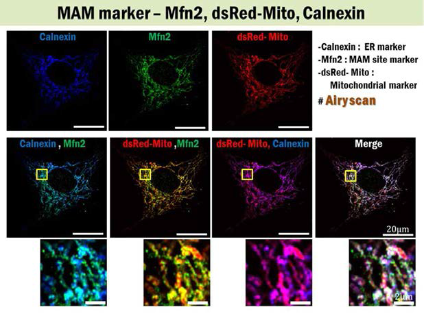 ER 막단배질인 Calnexin, mitochondria로 타겟되는 형광단백질인 dsRed-Mito, 접속위치 단백질인 Mfn2가 겹치는 신호 (merge의 하얀색 부분)을 관찰할 수 있음