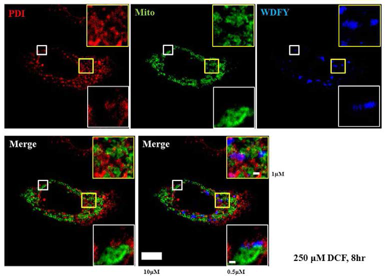 DCF 처리 시 유발되는 omegasome 생성이 MAM에서 발생하는지를 confocal 현미경으로 조사함. Blue (omegasome)이 yellow (green+red)와 겹침을 관찰함