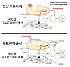 약물에 따른 오토파지 손상과 소포체 스트레스 증가로 인한 세포사멸 유발 현상