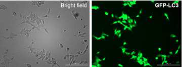 GFP-LC3 stable 세포주