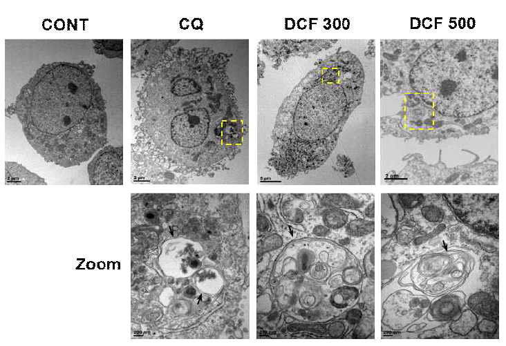 TEM을 통해 확인한 Diclofenac에 의한 오토파고좀 축적
