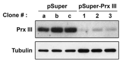 siRNA method를 통한 Prx III의 발현 억제 확인