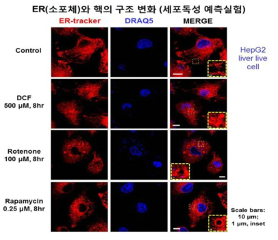 ER tracker dye와 DRAQ5 dye 염색법과 confocal imaging을 통한 live HepG2 세포에서 약물 처리 시, ER과 핵의 구조 분석