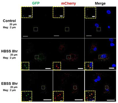 mCherry-eGFP-LC3 발현 HepG2 세포에 8시간동안 영양분 고갈시킨 후에 confocal 영상 분석