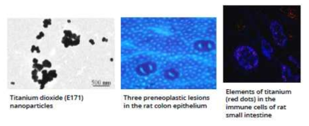 이산화티타늄 나노입자(E171) 지속섭취에 의한 전암병변 발생 및 면역체계 이상 소견(Bettini, 2017)