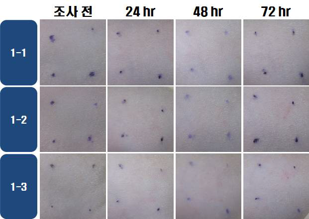 IBF 0.1 w/v %의 광조사량 선정시험 결과 ( 20 J/cm2 )