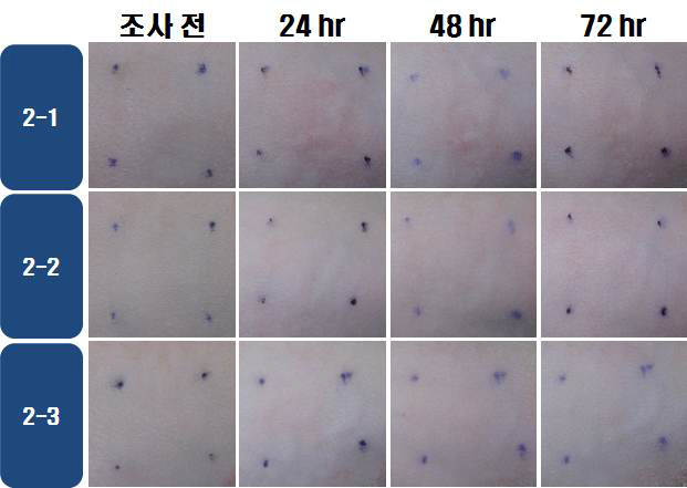 IBF 10 w/v %의 광조사량 선정시험 결과 ( 20 J/cm2 )