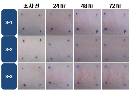 IBF 25 w/v %의 광독성 시험 결과