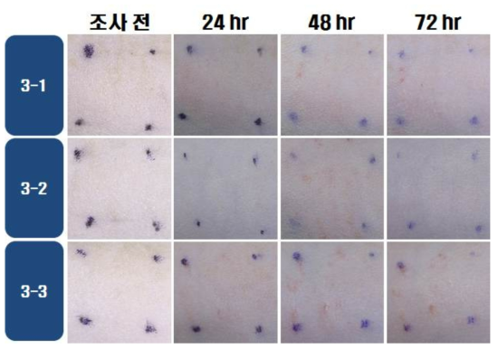 KPF 80 w/v %의 광독성 시험 결과